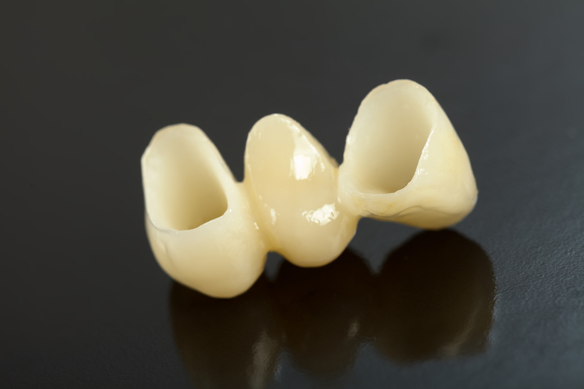 crowns2_20506917_xl-2015