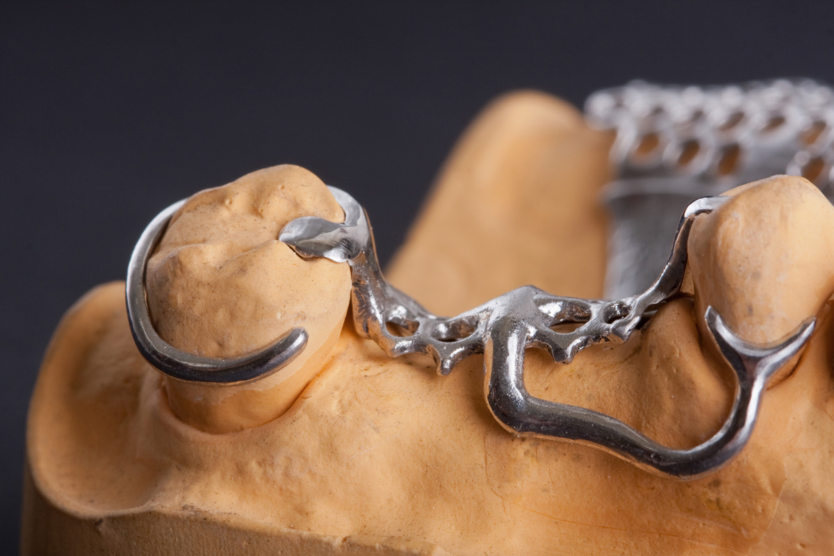dentures1_8834980_xl-2015